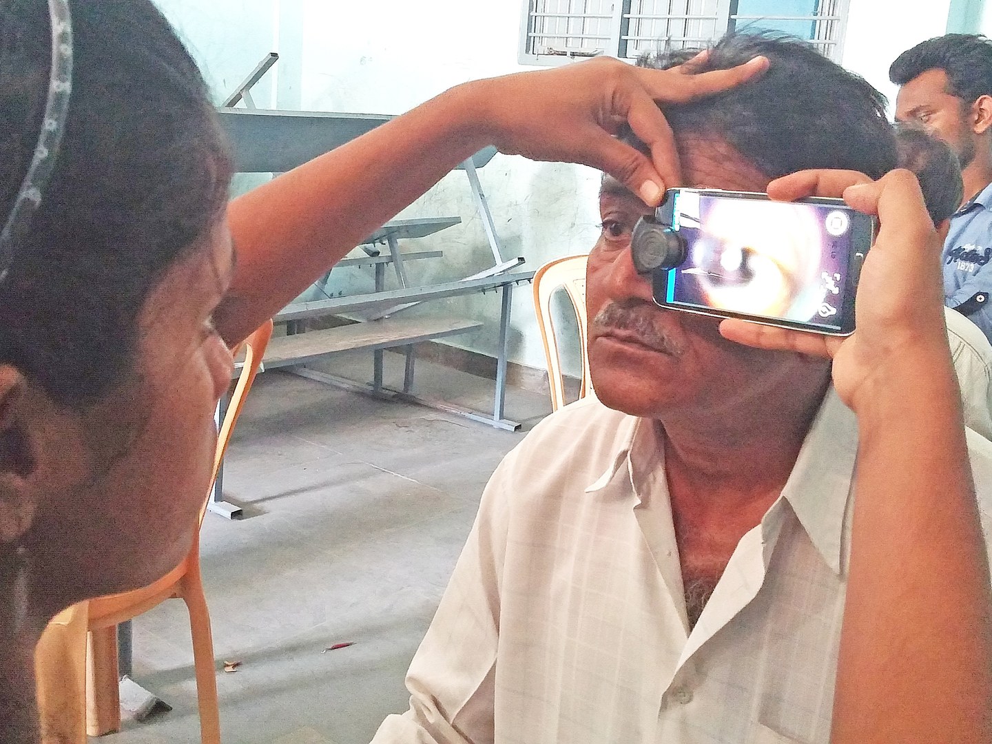 Augen-Screening mit umgerüsteten Smartphones in Indien: