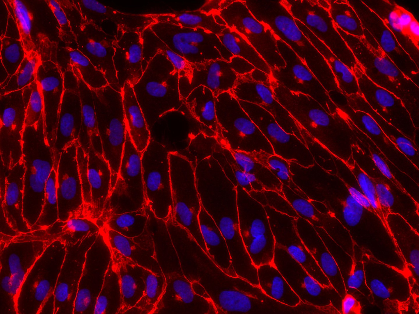 Immunofluorescence image:  endothelial cells differentiated in the culture dish from ETV2 iso2 hiPSCs in red. The cell nuclei are blue.